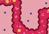 Diverticulitis: the debilitating bowel disorder that’s weakening our guts